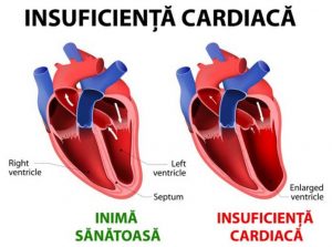Ce sunt hipertensiunea, insuficienta cardiaca si tromboembolismul venos?