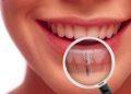 Cum sa-ti pastrezi in conditii optime implantul dentar?