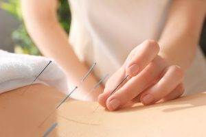 Acupunctura: pregătirea pentru o experiență benefică