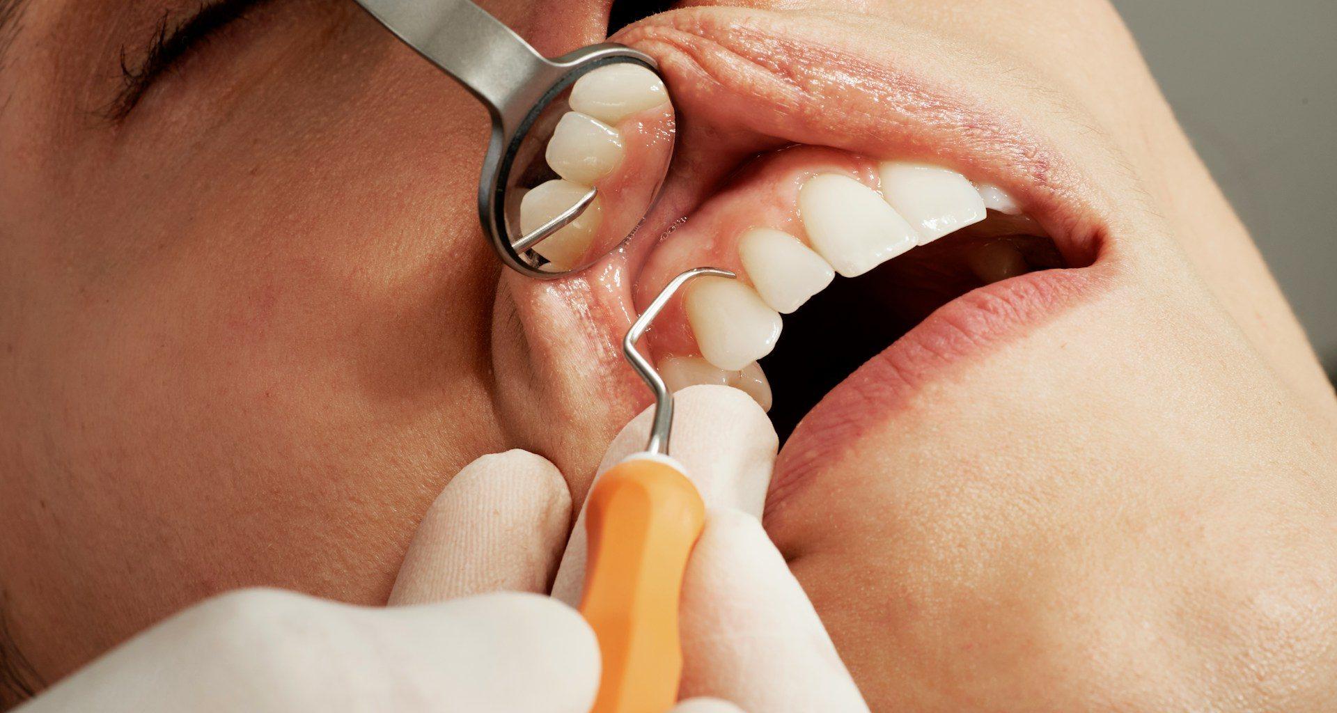 Cum pot fi corectate anomaliile dentare