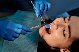 Cum să alegi corect procedura dentară potrivită pentru tine