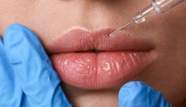 augumentarea buzelor